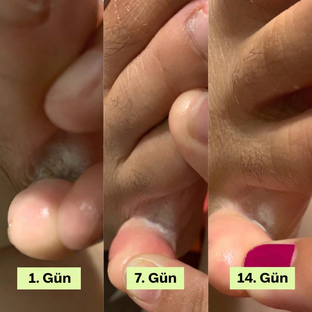 Doğal Kaşıntı Karşıtı Sabun