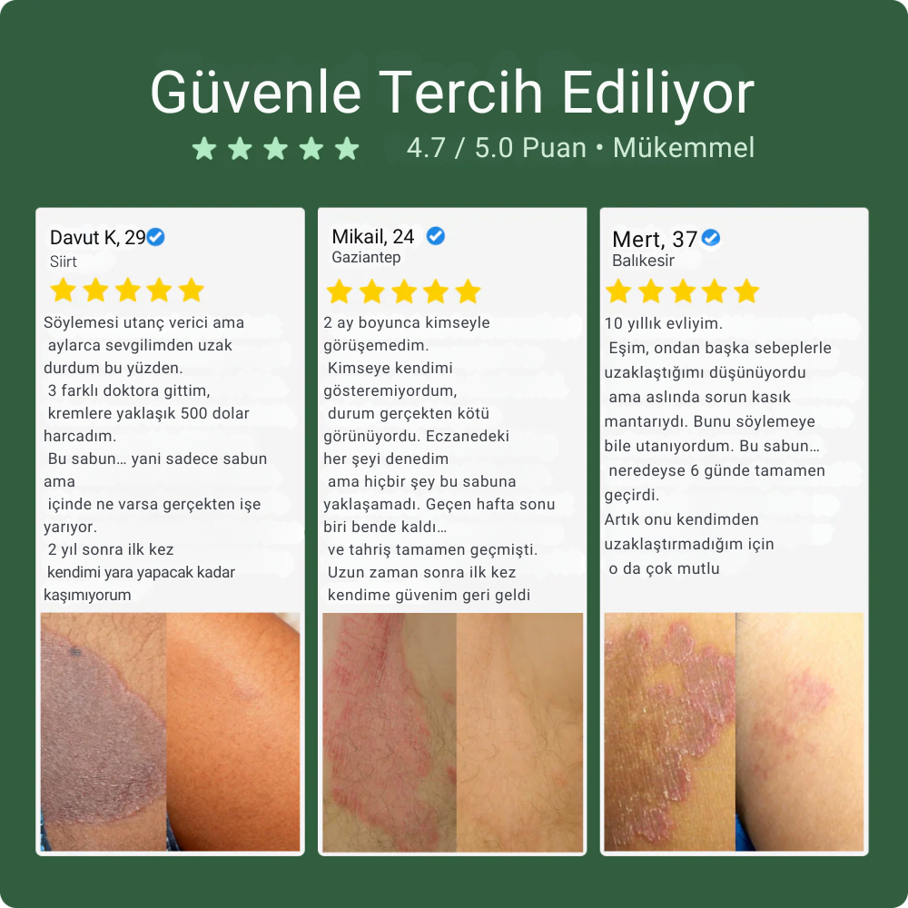 Karuvel® Mantar Karşıtı Sabun